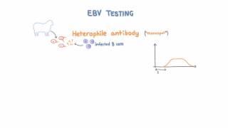 Epstein Barr Virus (EBV) Diagnosis and Testing