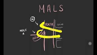 Median arcuate ligament syndrome (MALS)