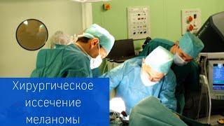 Хирургическое иссечение меланомы