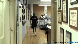 Below the knee amputee walks for the first time!