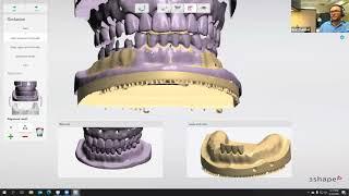 Digital Dentistry Training Series: Advanced Denture Design