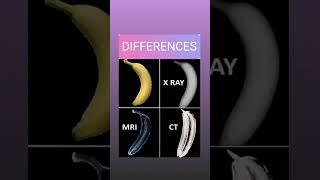 Difference between X-ray, MRI and CT scan #short #shorts #shortsfeed