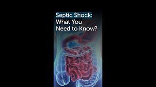 What You Should Know About Septic Shock: Guidance from Dr. Singarapu Maneendra | Gleneagles Hospital