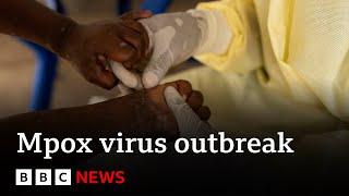 Sweden confirms first case of new mpox variant | BBC News