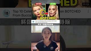 什麼人容易有牙套臉，最後一個原因矯正醫師可盡量控制#牙齒矯正