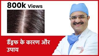 How To Get Rid Of Dandruff ( डैंड्रफ के कारण और उपाय) | HairMD, Pune | (In HINDI)