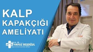 Kalp Kapakçığı Ameliyatı | Kalp ve Damar Cerrahisi - Prof. Dr. Yavuz Beşoğul