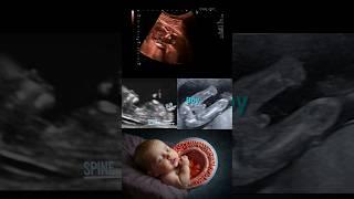 Baby boy ultrasound report #pregnancy #shorts