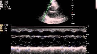 Beijing Konted C23 ultrasound for  Cardiologist