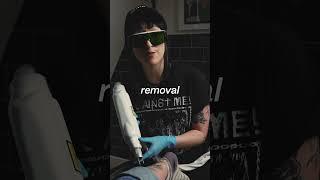 Can you use numbing cream for laser tattoo removal ? #lasertattooremoval