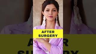 Rubina Dilaik Before And After Plastic Surgery | Entertainment News | Her Zindagi