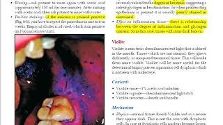 investigation in dentistry   LUGOL'S IODINE TEST , VIZILITE , PHOTODIAGNOSIS