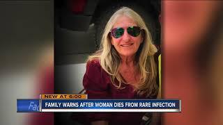 Wisconsin woman dies after dog lick