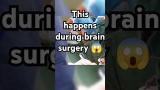 This happens in Brain surgery #shorts #ytshorts #brain #brainpower