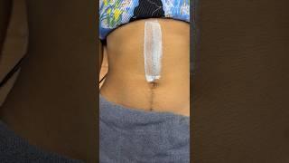 #shortsvideo Full growth hair tummy waxing by rica wax #waxingtips #ricawax #skincare #tummywax