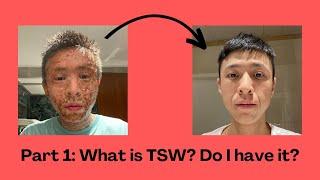 What is Topical Steroid Withdrawal? Do I have it? (TSW Guide part 1)