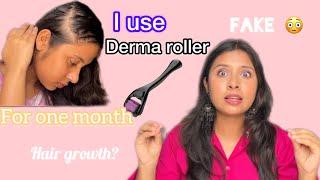 I Use DERMA ROLLER On My Hair For 1 Month And THIS IS WHAT HAPPENS?