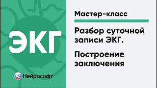 Разбор суточной записи ЭКГ. Построение заключения | Мастер-класс