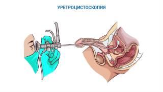 Цикл видео-лекций «Популярная урология». Стриктура уретры (часть 2-я). Диагностика заболевания