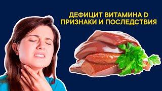 ВИТАМИН Д: для чего нужен, последствия дефицита, в каких продуктах содержится витамин D