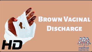 Brown Vaginal Discharge: Everything You Need To Know