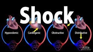 Shock, Pathology of Different Types, Animation