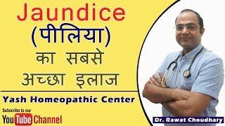 Jaundice (पीलिया) का सबसे अच्छा इलाज | Best Treatment of Jaundice