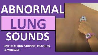 Lung Sounds (Abnormal) Crackles (Rales) Wheezes (Rhonchi) Stridor Pleural Friction Rub Breath Sounds