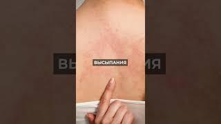 3 признака проблем с печенью / Как понять, что пора к врачу #shorts