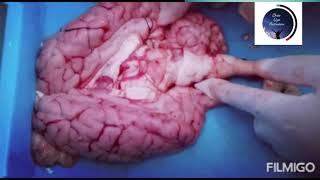 Nervous System Control and Co ordination - TMR Nizambad Girls 2