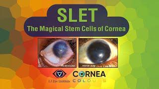 Cornea Colours | SLET - The magical stem cells of cornea