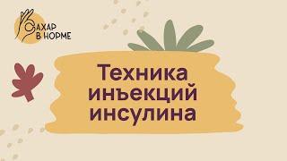 Лечение диабета. Техника инъекций инсулина