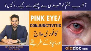 Ashob E Chashm Ka Ilaj In Urdu - Pink Eye Infection In Lahore - Conjunctivitis In The Eye Treatment