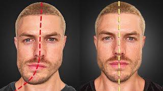 How to Fix Jaw & Face Asymmetry (FOREVER)