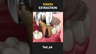 If I swallow my tooth #dental care #dental tips  #dentist  #dental health#shorts #short feed