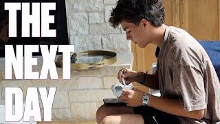 WISDOM TEETH REMOVAL RECOVERY | THE DAY AFTER SURGERY | HOW PAINFUL IS IT?