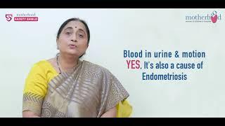 Signs and Symptoms of Endometrioses - Dr. Suhasini Inamdar - Motherhood Hospital, Indiranagar.