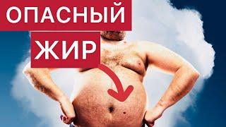 ОЖИРЕНИЕ  Печальные последствия ИЗЛИШНЕГО ВЕСА  Как СЖЕЧЬ ОПАСНЫЙ ЖИР  OBESITY @TOMYSEYE