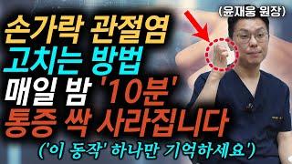 "수술 안 해도 충분히 좋아집니다" 손가락 마디 통증 사라지는 '10분' 초간단 치료법 l 윤재웅 원장