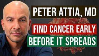 Peter Attia, MD: How to Detect Cancer Early - Before it Spreads