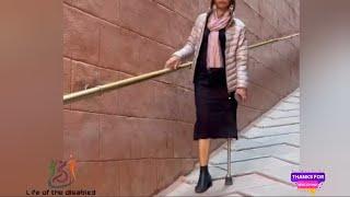 The beautiful amputee woman challenges disability with an artificial leg #amputee