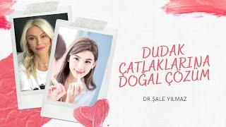 DUDAK ÇATLAMASI NEDEN OLUR? (DUDAK ÇATLAMASINA DOĞAL ÇÖZÜM) Dr ŞALE YILMAZ