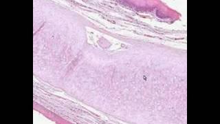 Shotgun Histology Epiglottis