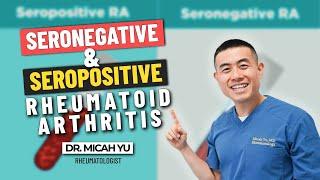 Seronegative and Seropositive Rheumatoid Arthritis (RA) | Rheumatologist Dr. Micah Yu