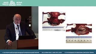 Practice of laparoscopic surgery for cervical cancer: Petrov center of oncology (Igor Berlev)