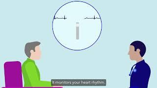 ILR Unexplained Stroke