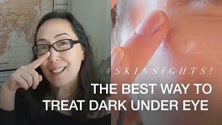 The Best Way To Treat Dark Under Eye | VMV Hypoallergenics Snippet