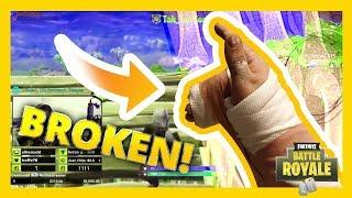 I BROKE MY HAND DURING A FORTNITE GAME!