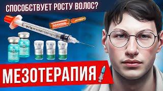 МЕЗОТЕРАПИЯ ДЛЯ ВОЛОС | Помогает ли мезотерапия при выпадении волос? | Плазма | МЕЗО