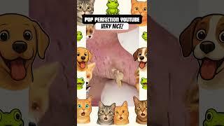 Wow! #pimple #pimplepopper #pimples #shortsfeed #shortvideo #shorts #short #youtubeshorts #youtube
